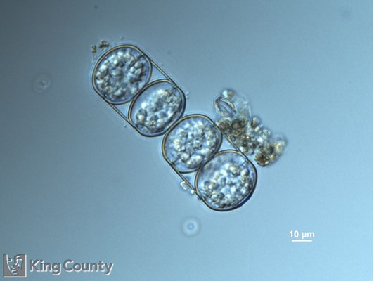 Photo of Melosira moniliformis